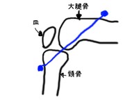 再建手術はこんな感じ